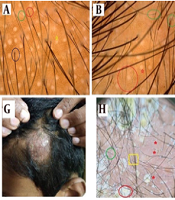 J Skin Stem Cell